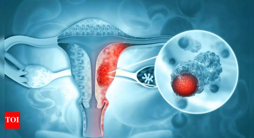 Microplastics discovered in human ovaries: implications for women's health