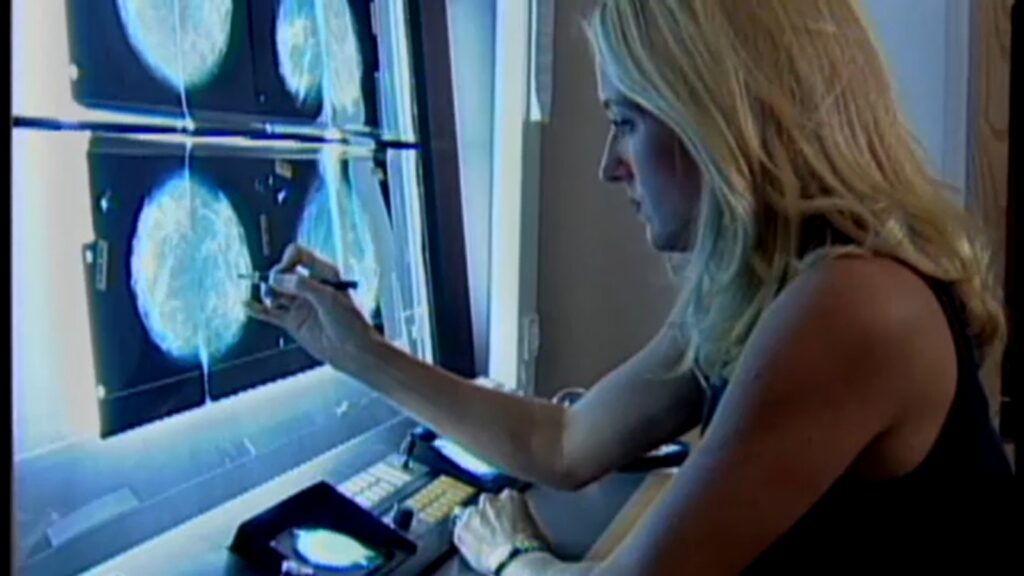 Mammograms: key to identifying women's heart disease risk