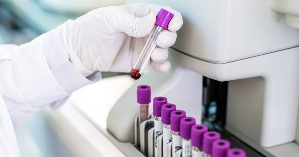 Silent inflammation: a hidden heart risk for healthy women