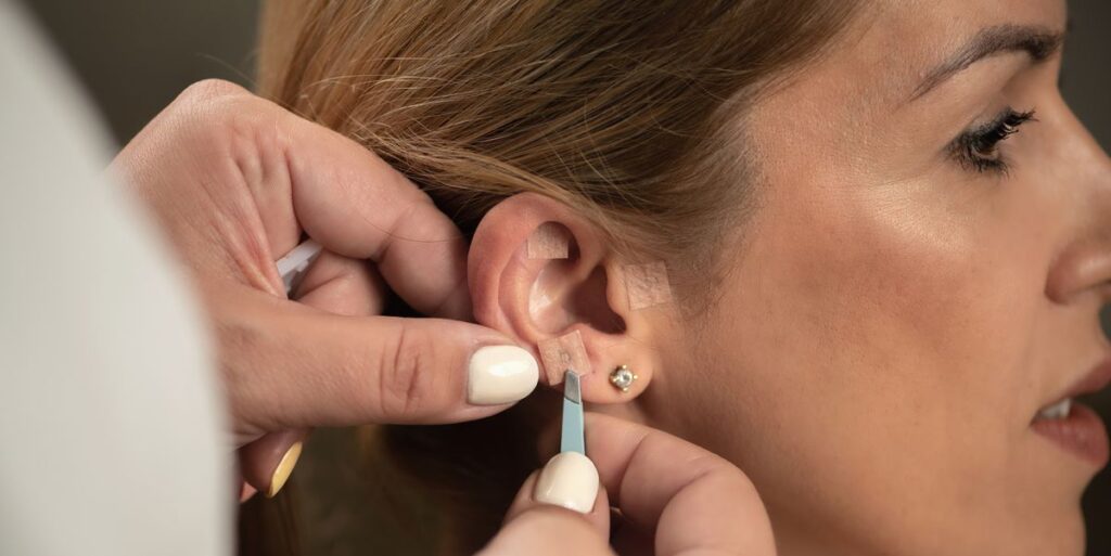 Ear seeding: your guide to benefits, usage, and sourcing