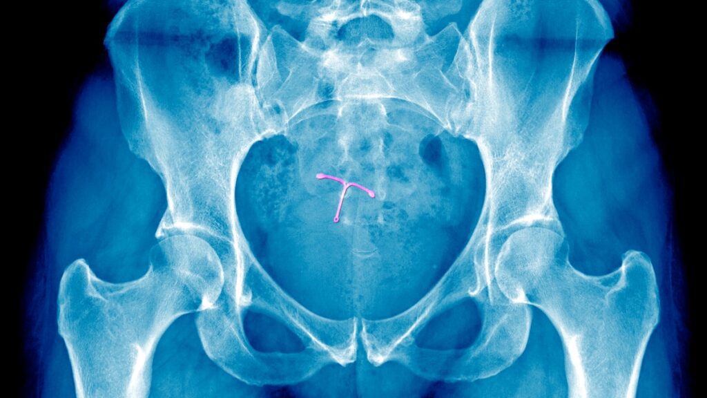 Rethinking women's pain: a shift in medical attitudes