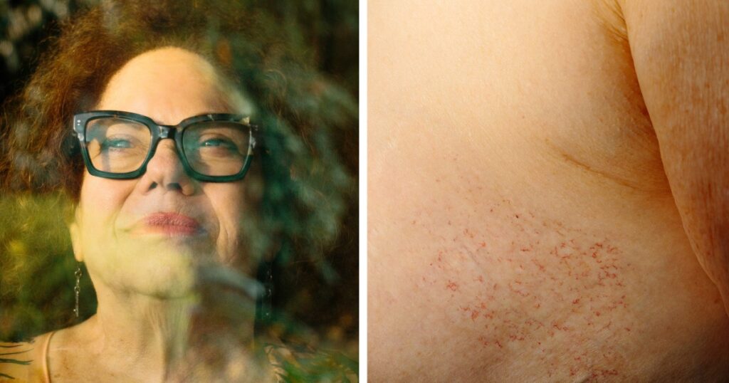 Rising barriers: u.s. women facing obstacles in accessing vital breast