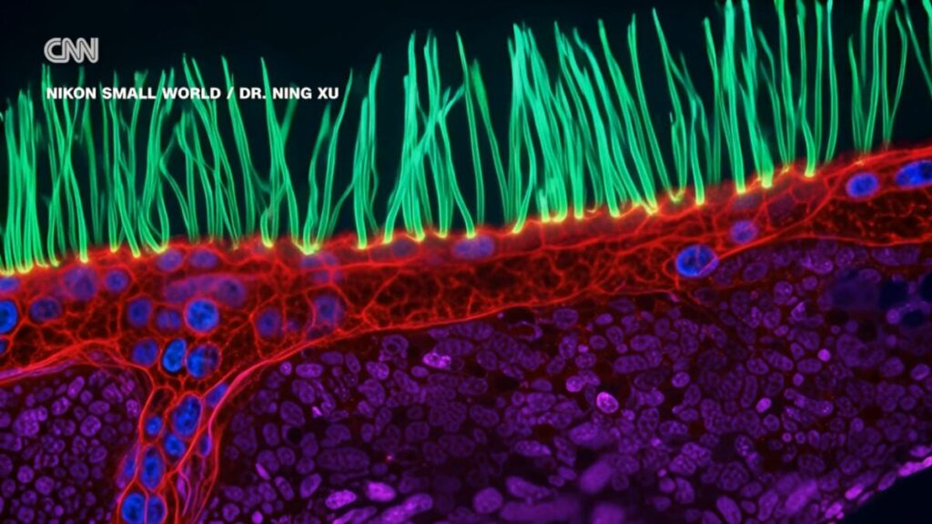 Contest Winning Microscope Video Is Full of AI Confabulations, Scientists Say
